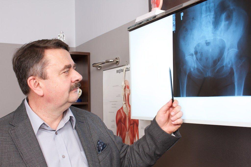 lekarz pokazujący zdjęcie rentgenowskie